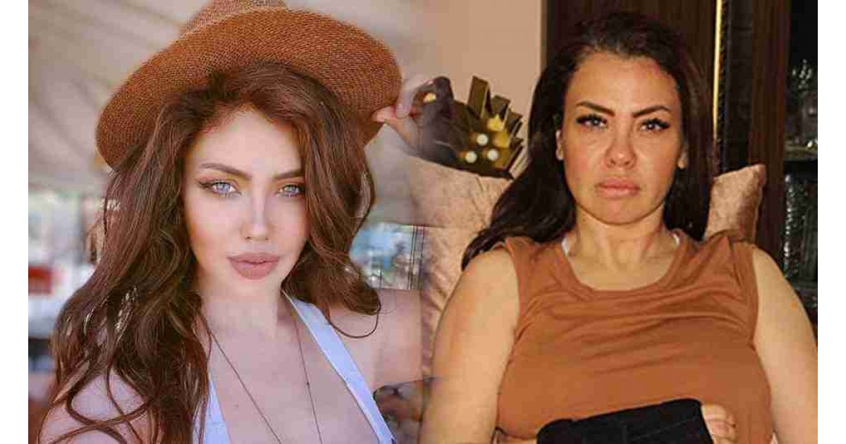 Dudağımla pipet bile tutamıyorum demişti! Şarkıcı Lara tam bir estetik harikası oldu! Son hali ’Yok artık’ dedirtti 