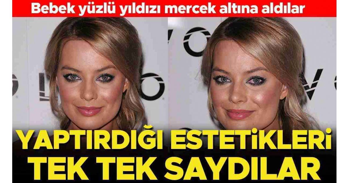 Bebek yüzlü yıldızı mercek altına aldılar: Yaptırdığı estetikleri tek tek saydılar 