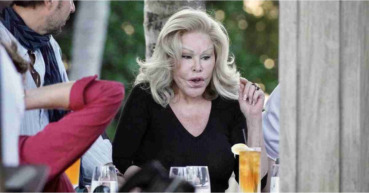 'Kedi kadın' Jocelyn Wildenstein yüzünün eski halini paylaştı