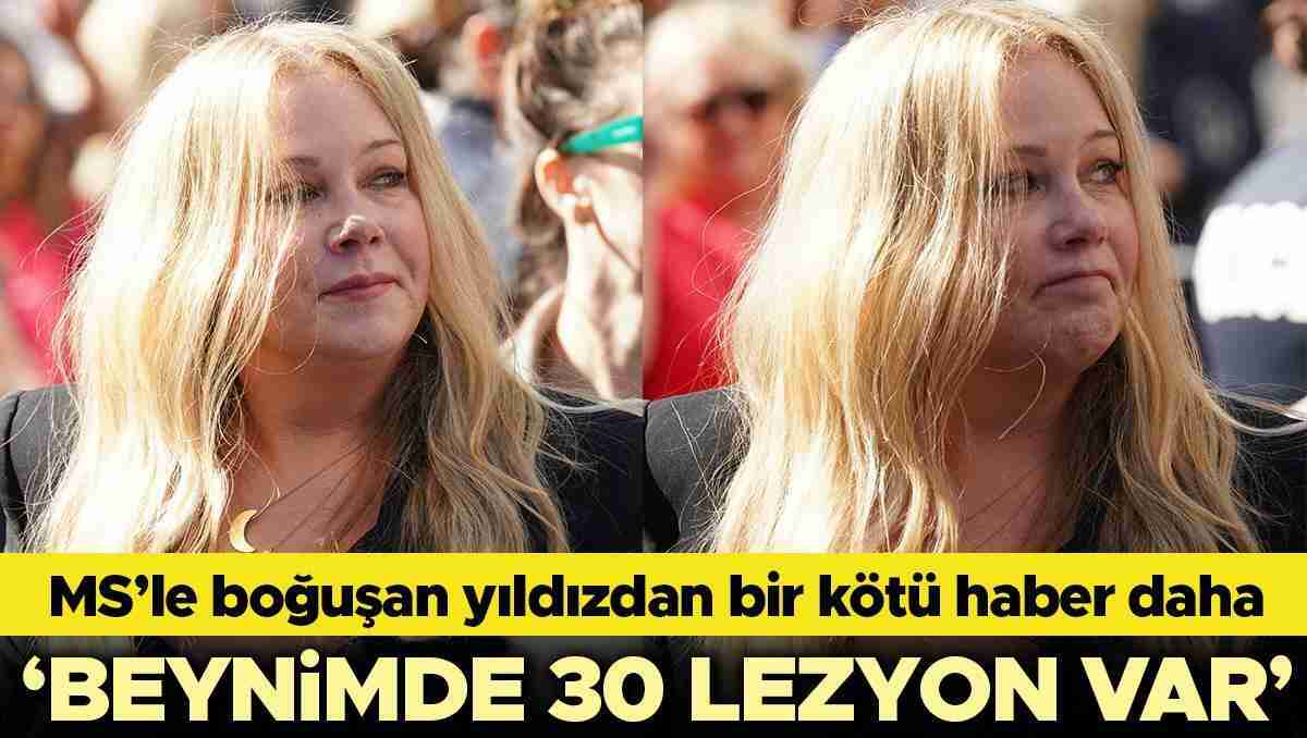 MS'le boğuşan yıldız oyuncudan bir kötü haber daha: Beynimde 30 lezyon var 