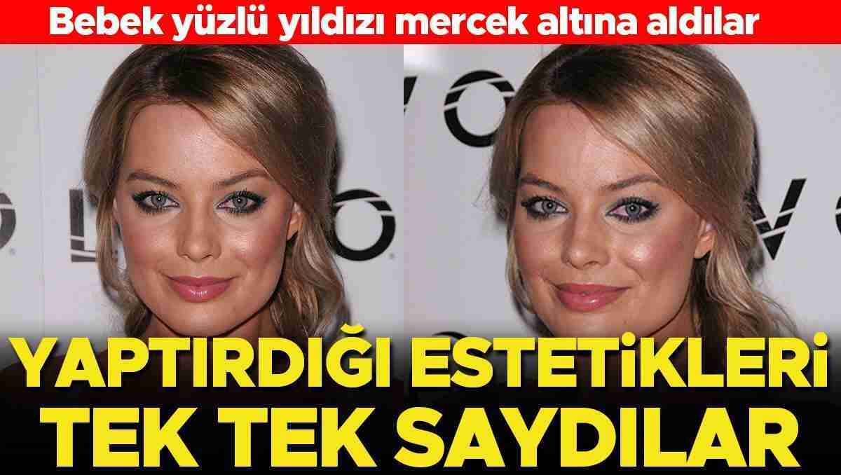 Bebek yüzlü yıldızı mercek altına aldılar: Yaptırdığı estetikleri tek tek saydılar