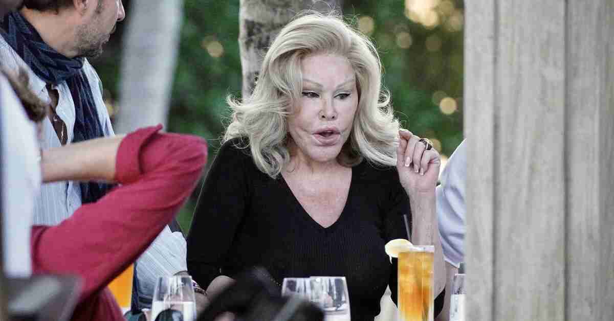 'Kedi kadın' Jocelyn Wildenstein yüzünün eski halini paylaştı